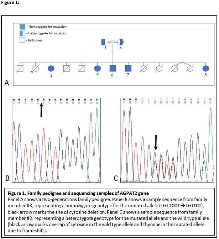 Figure 1. Family pedigree and sequencing samples of AGPAT2 gene